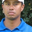 Tiger Woods, operado con xito en la rodilla izquierda