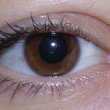 Cientfico de Estados Unidos inventa ojo binico que permite ver a los ciegos