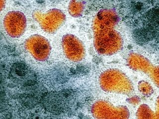 Primera muerte por la �s�per gripe� A H3N2 en el pa�s: Alerta por una variante importada