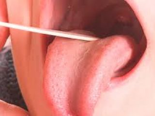 Muere adulto en Pergamino por la bacteria estreptococo