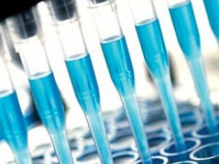 Gran avance para producir test serolgicos de coronavirus en Argentina