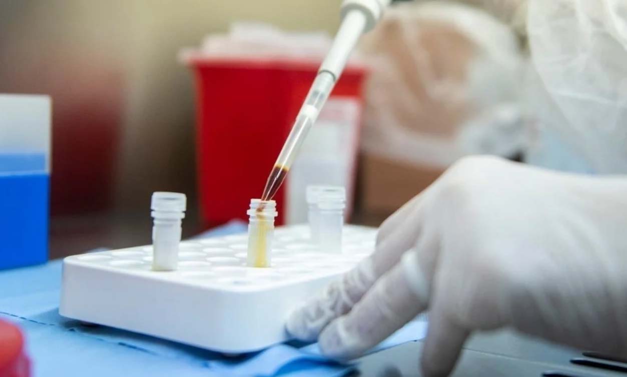 Pergamino: El test del caso sospechoso del menor dio negativo de Coronavirus