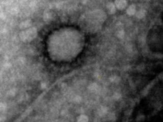 La primera foto del coronavirus que circula en Argentina