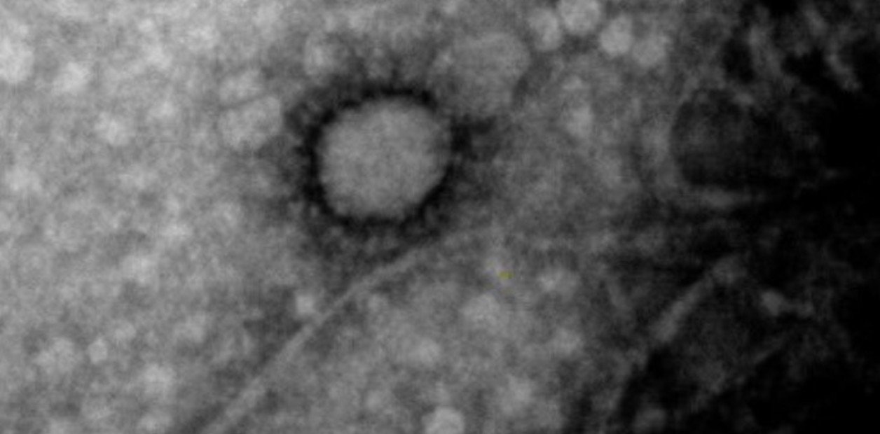 La primera foto del coronavirus que circula en Argentina