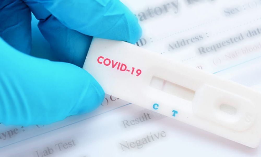 Contagios de Coronavirus en baja