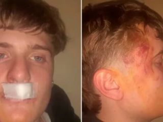 Otra vez: Brutal ataque de rugbiers a un joven en Zrate conmociona a la comunidad
