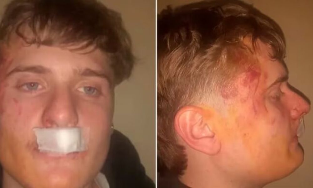 Brutal ataque de rugbiers a un joven en Zárate