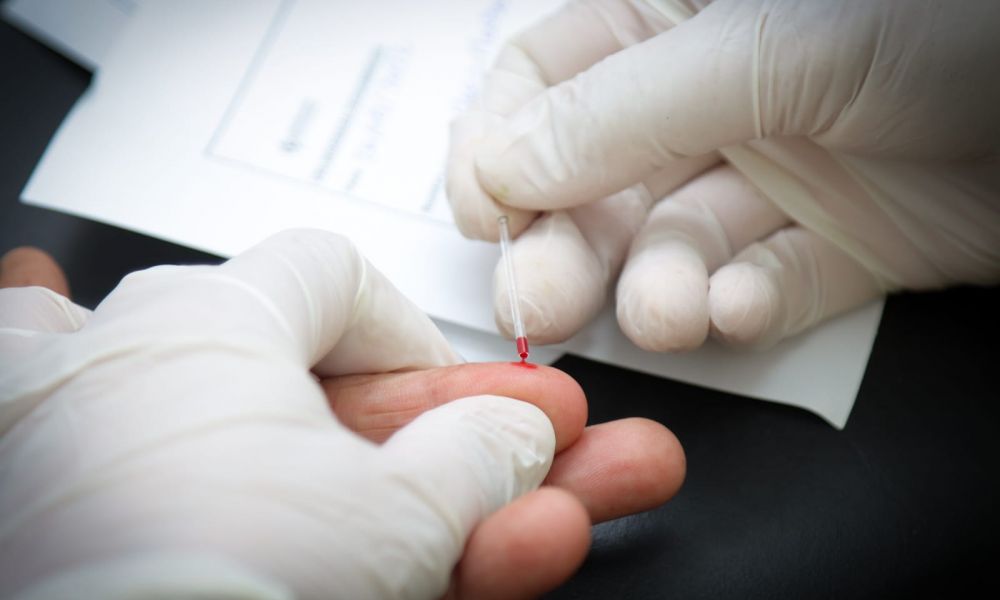 Jornada de testeos gratuitos de VIH, Hepatitis C y Sífilis