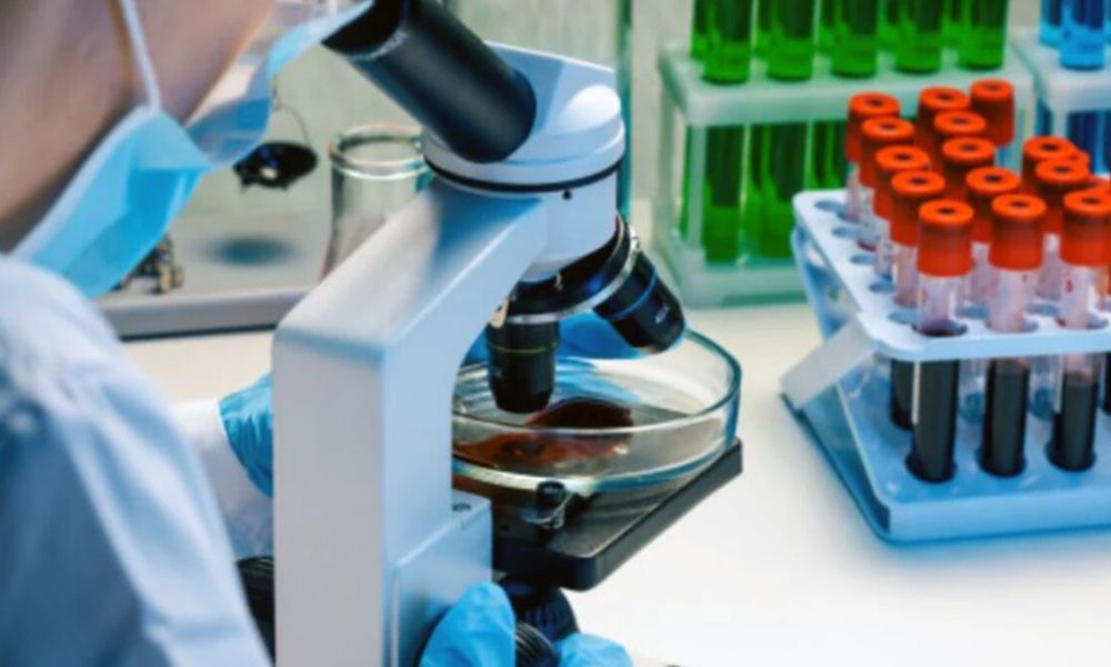 Fiebre tifoidea en el AMBA