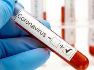 Pergamino: Mi�rcoles con 64 nuevos casos positivos y un fallecido con Covid-19