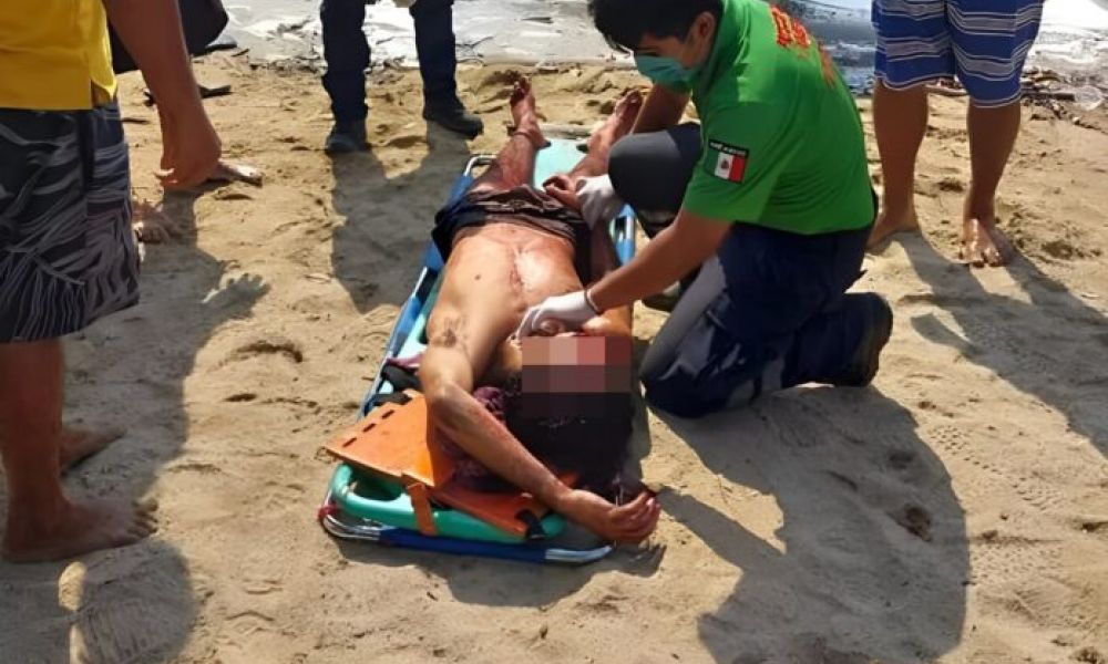 Brutal ataque a machetazos a 3 argentinos en México