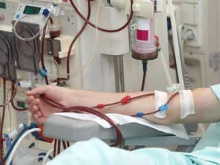 Enfermedad renal crónica en Argentina: Alertan por la calidad de los tratamientos de diálisis