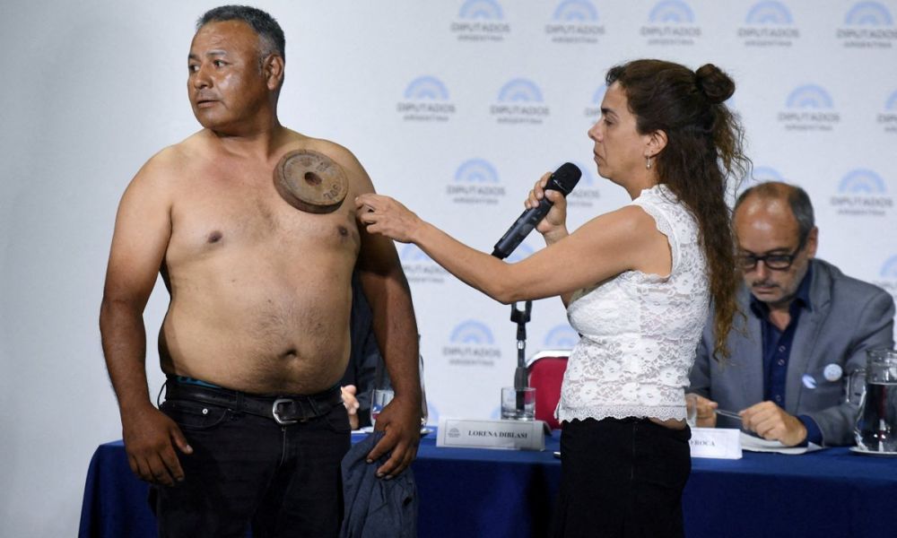 Chequeado desmonta el mito de la «magnetización»