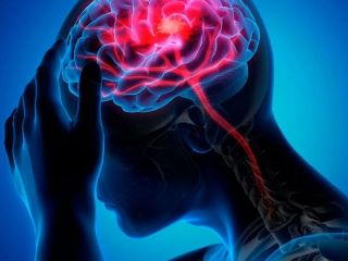 Migraña en aumento: Alerta por el crecimiento de casos en jóvenes y hombres