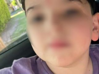 Basti�n volvi� a ser operado: S�ptima intervenci�n y evoluci�n estable