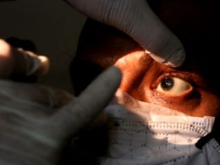 Hongo negro: una infeccin oportunista asociada al Covid-19 cuando las defensas estn bajas