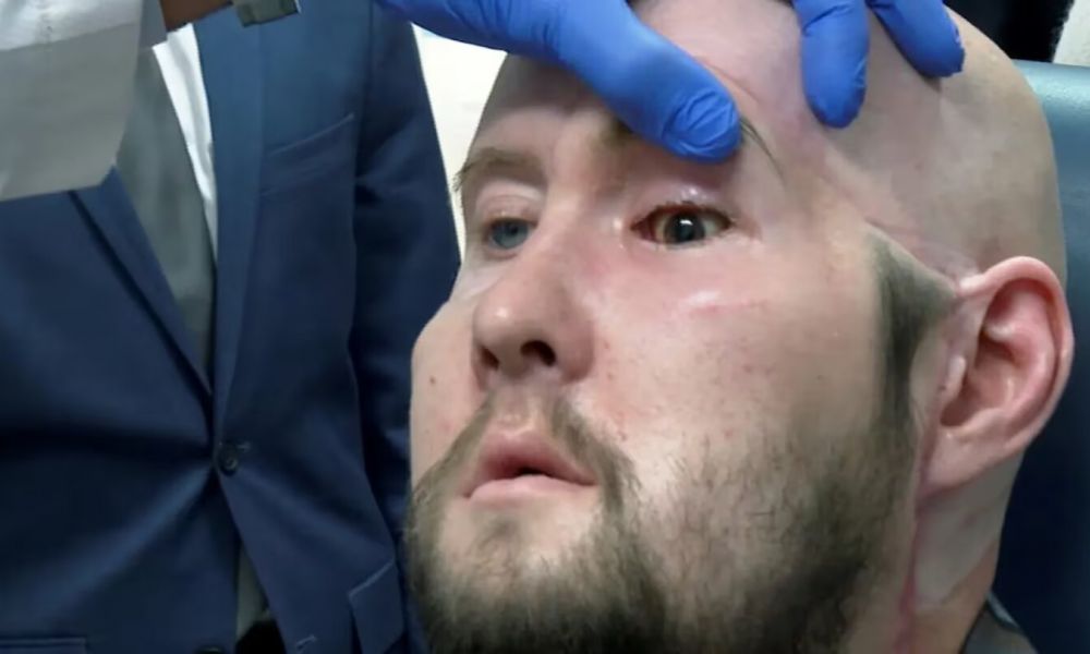 Aaron James (Foto: AP)