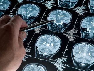 Un software argentino podra diagnosticar de forma precoz el Alzheimer
