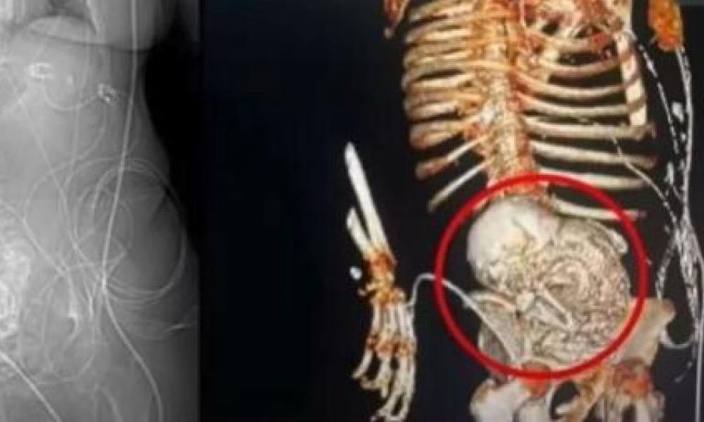 El misterio de la Litopedia